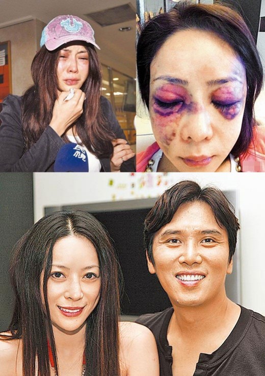 대만 미녀모델 왕자어 얼굴 중상...51세 재벌 남친에게 폭행당해