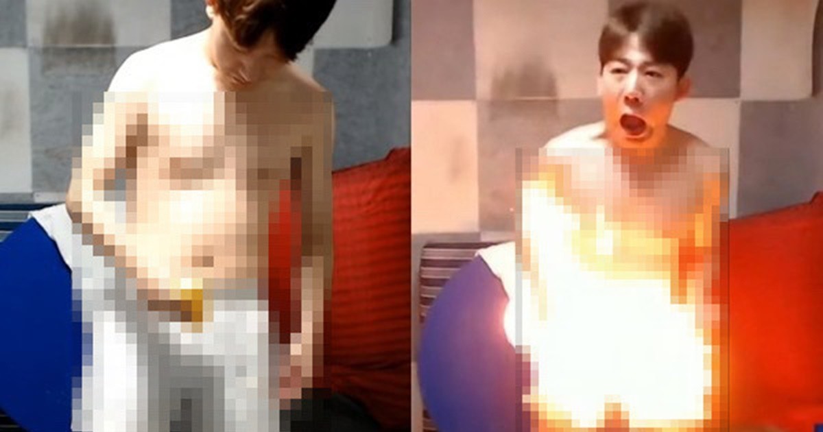 생방송서 신체 주요 부위에 불 지른 신태일..."2도 화상 입었다"