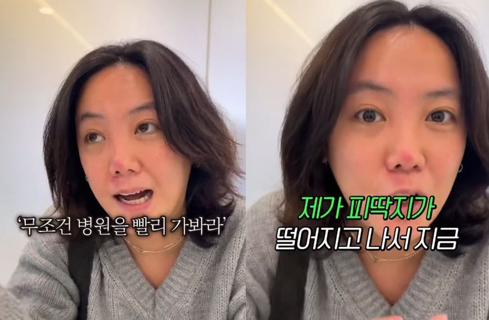 빙판길 낙상사고 당한 고은아, '재건코 이상無' 소견에 안도... 얼마나 무서웠는지