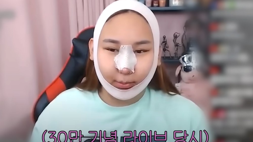 풍자, 성형 당일에도 방송 강행...구독자 급증해 쉴 수 없었다 ('A급장영란')