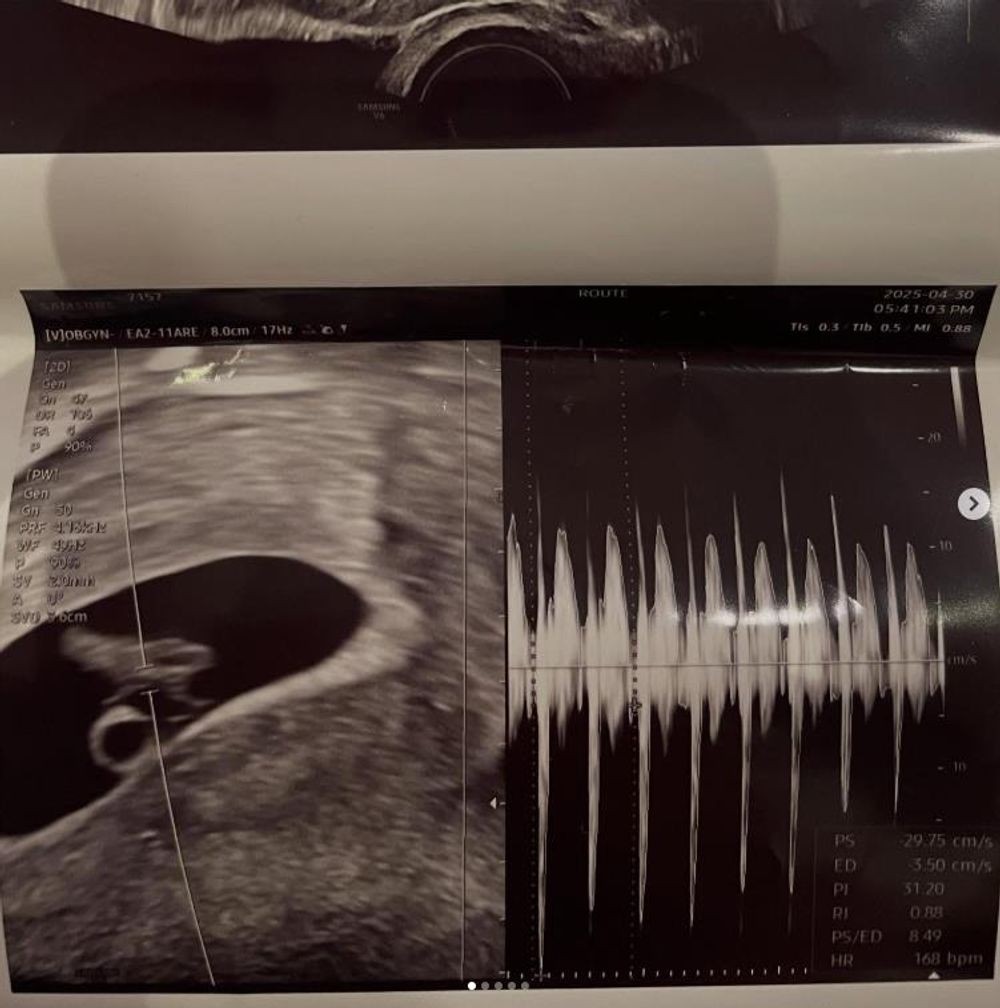 Seo Min-jae's Ultrasound Photo