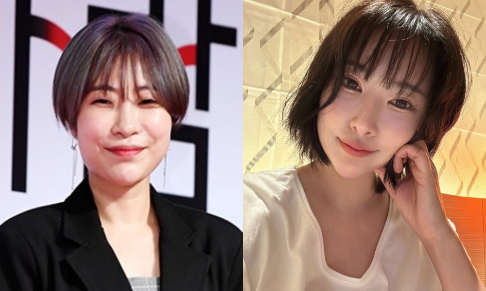 '성형 수술비용만 1억 5000만 원' 이세영