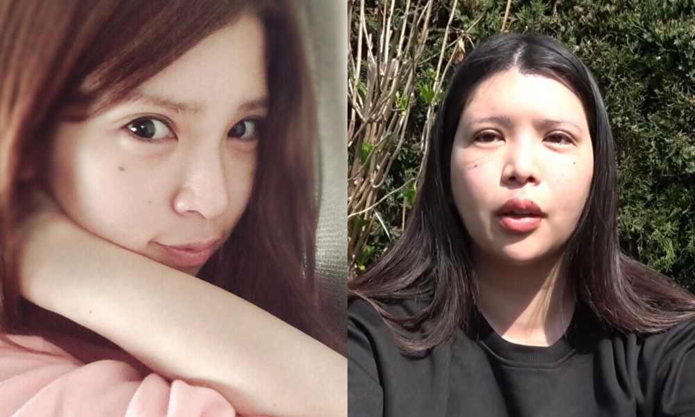 대표 이미지