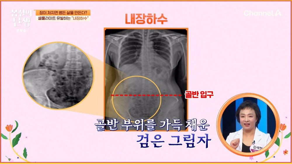 대표 이미지