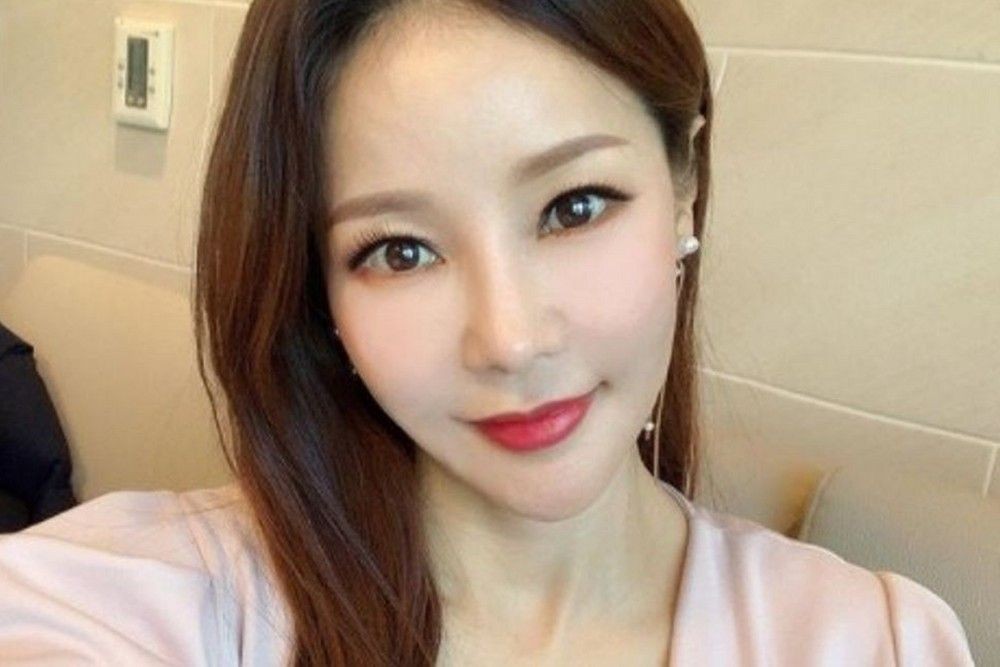 ‘류필립♥’ 미나, “가족 다 잃고 내 차례 같아”…대장 선종 정기 검진→지속적으로 제거 [RE:뷰]