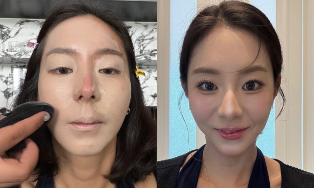 대표 이미지