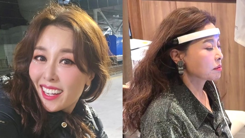 ’32kg 감량’ 홍지민, 52세에 폐경→정수리 ‘탈모’ 진단…흑채+병원서 주사까지 [RE:뷰]