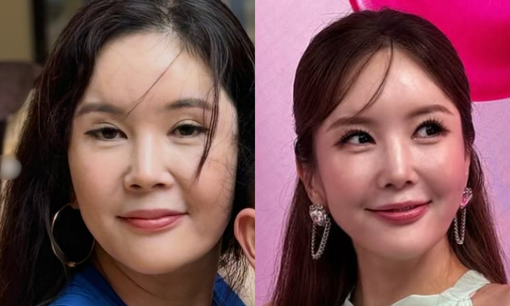 대표 이미지