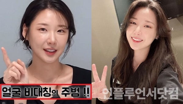 10년 차 피부과 직원..."이 습관만 버려도 예뻐질 수 있다!"