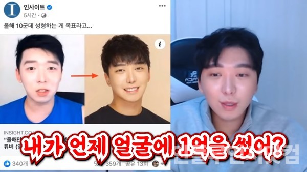 유튜버 강학두, '성형에 1억 썼다'는 보도에 "덕분에 콘텐츠 생겼다"
