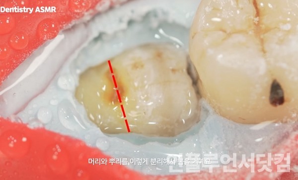 유튜브 '치대남_치과의사 고광욱_Dentist' 채널