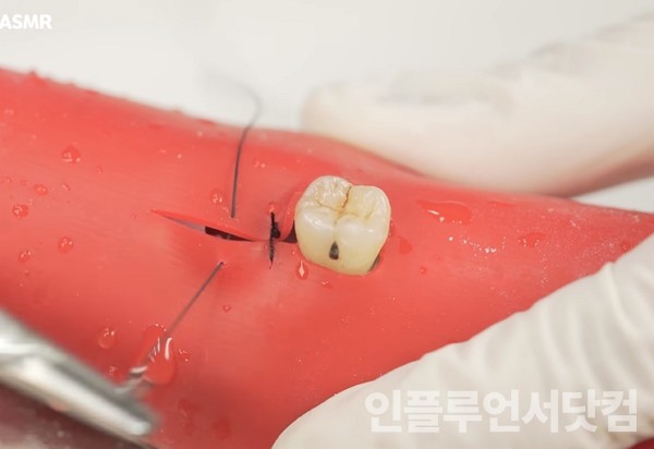 유튜브 '치대남_치과의사 고광욱_Dentist' 채널