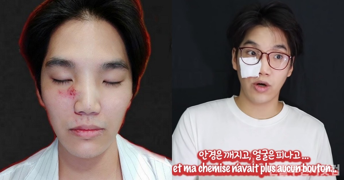 프랑스에서 인종차별 당한 한국인 유튜버..."남자 15명에게 집단폭행 당해"