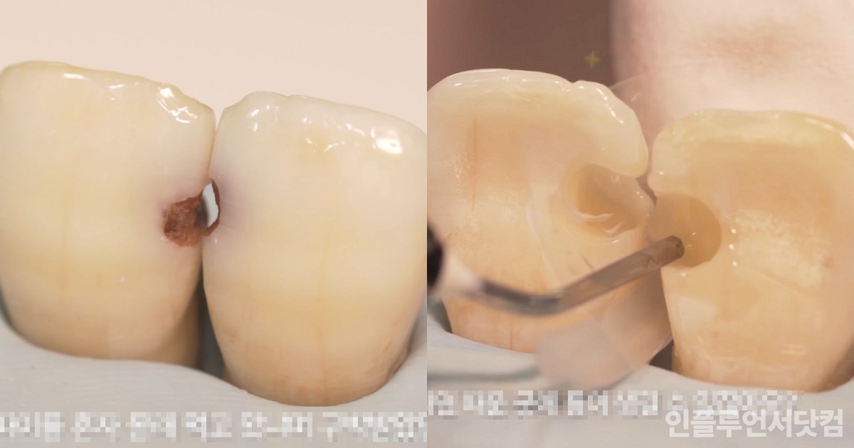 유튜브 '치대남_치과의사 고광욱_Dentist' 채널