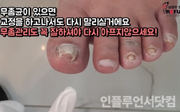 유튜브 '풋풋한Lee쌤 Fresh Foot' 채널