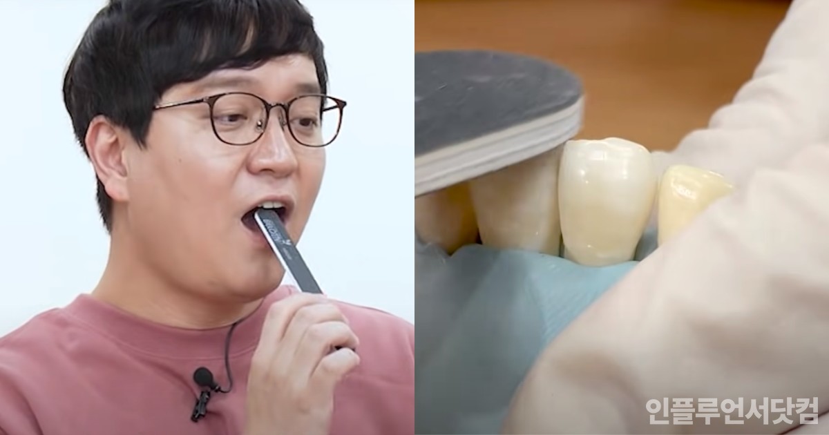 유튜브 ‘치대남_치과의사 고광욱_Dentist’ 채널